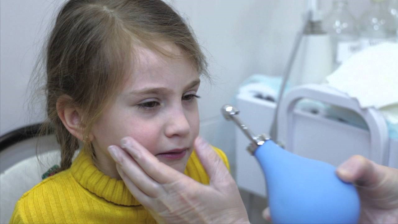 Лечение эксудативного отита